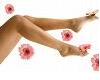 Varices y Celulitis